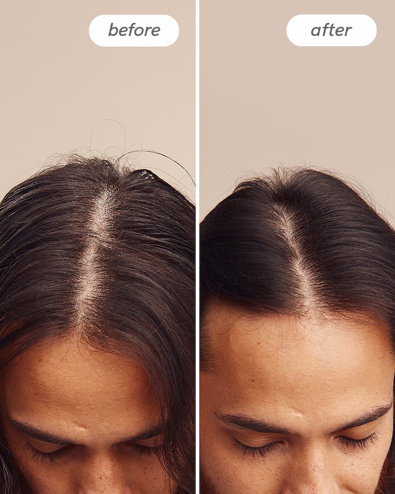 HAIRLU-5714628000834-3.jpg